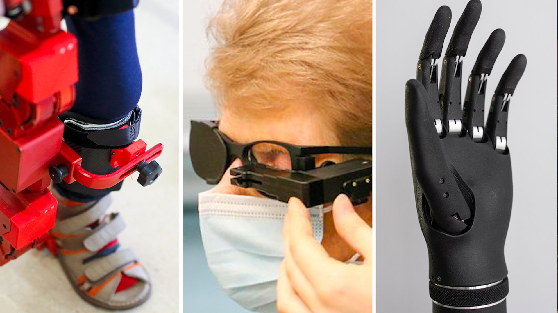 Split image (left to right) shows: a child's leg walking with a bionic exoskeleton, bionic eye transplant, and an innovative prosthetic hand