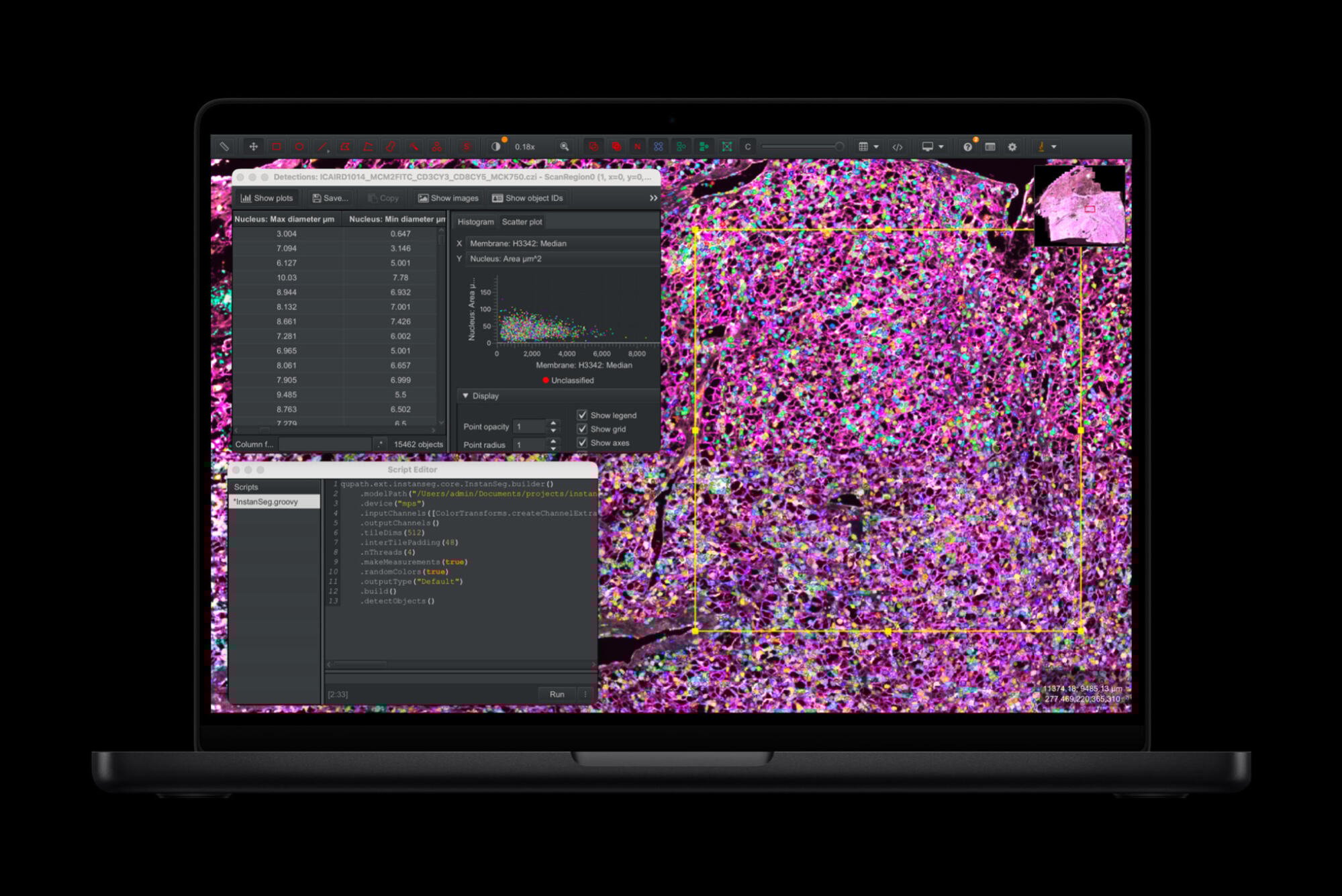 m5 macbook pro laptop with medical imaging program on display